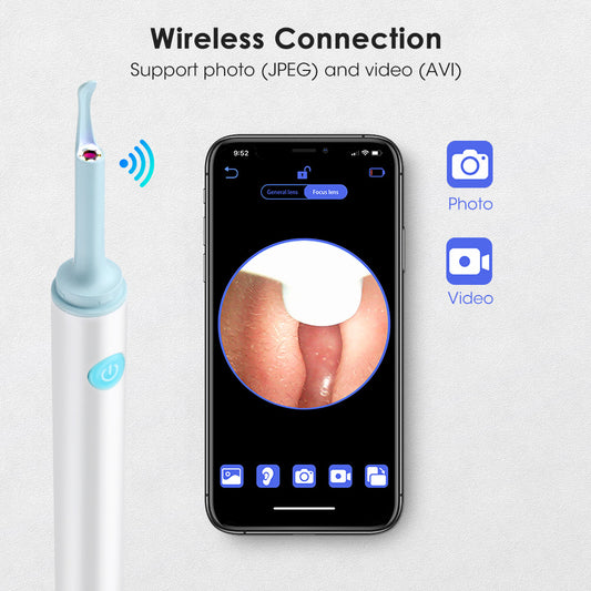 Smart WiFi Ear Cleaner with Camera